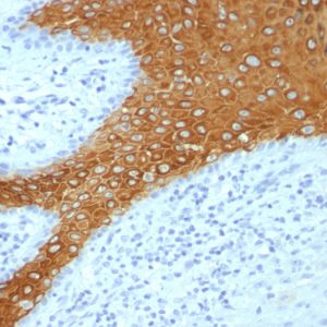 Formalin-fixed, paraffin-embedded human Skin stained with Cytokeratin 10 Monoclonal Antibody (KRT10/+ KRT10/1275).