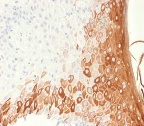 Recombinant Cytokeratin 10 (Suprabasal Epithelial Marker) Antibody