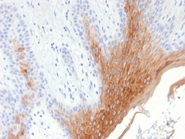 Recombinant Cytokeratin 10 (KRT10) (Suprabasal Epithelial Marker) Antibody