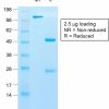 Recombinant Cytokeratin 10 (KRT10) (Suprabasal Epithelial Marker) Antibody - Image 2