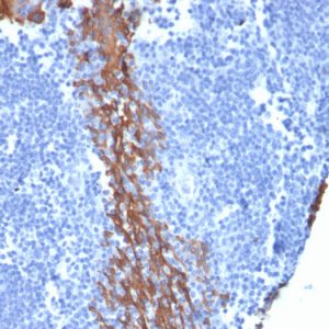 Formalin-fixed, paraffin-embedded human Tonsil stained with Cytokeratin 13 Mouse Monoclonal Antibody (KRT13/2659).