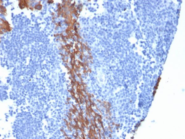 Formalin-fixed, paraffin-embedded human Tonsil stained with Cytokeratin 13 Mouse Monoclonal Antibody (KRT13/2659).