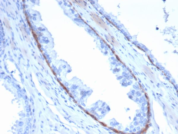 Formalin-fixed, paraffin-embedded human prostate stained with Cytokeratin 14 Mouse Monoclonal Antibody (KRT14/4132).