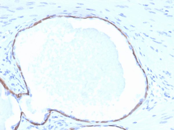 Formalin-fixed, paraffin-embedded human prostate stained with Cytokeratin 14 Mouse Monoclonal Antibody (KRT14/4132).