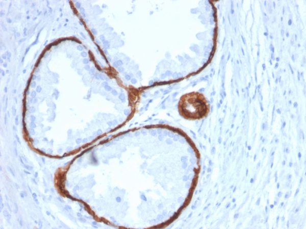 Cytokeratin 14 (KRT14) (Squamous Cell Marker) Antibody