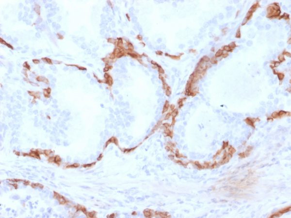 Cytokeratin 14 (KRT14) (Squamous Cell Marker) Antibody - Image 5