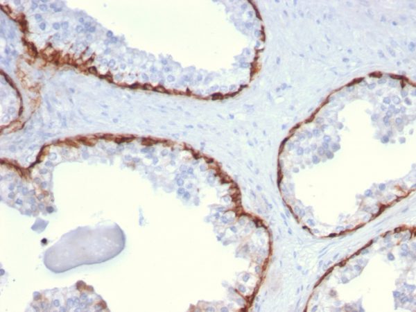 Cytokeratin 15 (Esophageal Squamous Cell Carcinoma Marker) Antibody