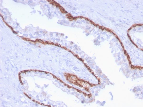 Cytokeratin 15 (Esophageal Squamous Cell Carcinoma Marker) Antibody - Image 2