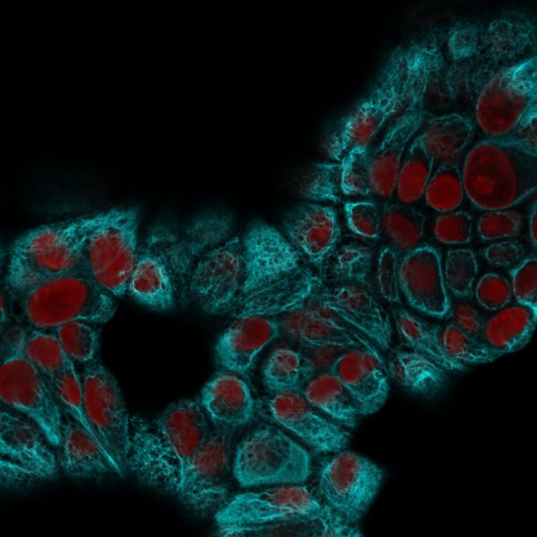 Cytokeratin 15 (Esophageal Squamous Cell Carcinoma Marker) Antibody - Image 3