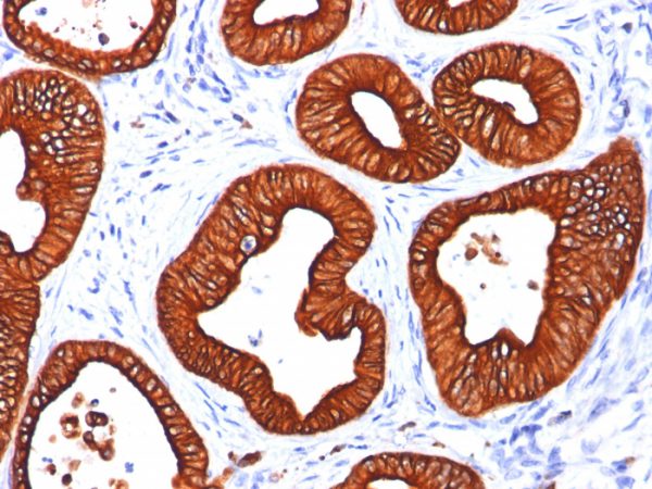 Formalin-fixed, paraffin-embedded human Skin stained with Cytokeratin 18 Mouse Monoclonal Antibody (DC10).