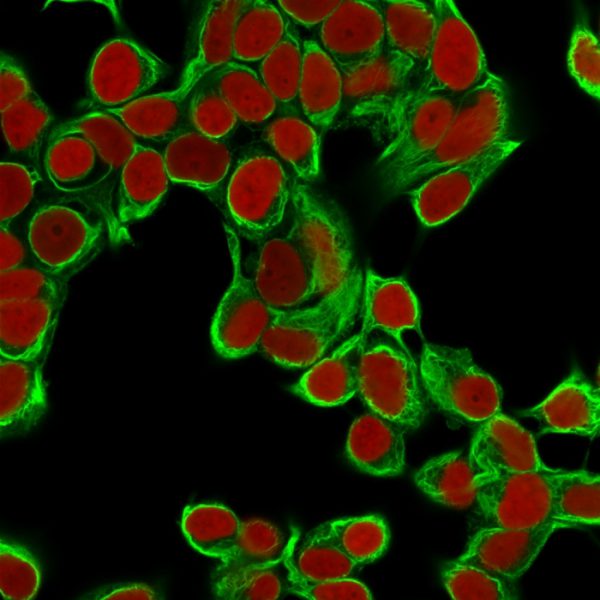 Cytokeratin 18 (KRT18) Antibody - Image 5