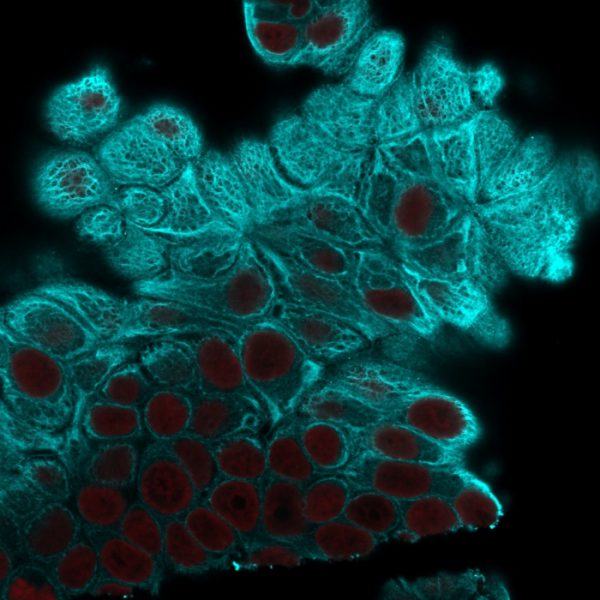 Immunofluorescence Analysis of MCF-7 cells labeling Cytokeratin 19 with Cytokeratin 19 Mouse Monoclonal Antibody (A53-B/A2.26) followed by Goat anti-mouse IgG-CF488 (Cyan). The nuclear counterstain is Reddot (Red)