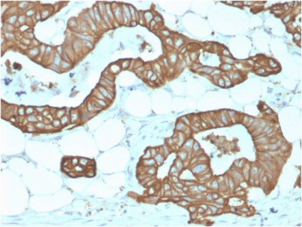 Recombinant Cytokeratin 19 (KRT19) (Pancreatic Stem Cell Marker) Antibody