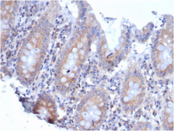 Formalin-fixed, paraffin-embedded human colonstained with Laminin Receptor Recombinant Mouse Monoclonal Antibody (rRPSA/6333).