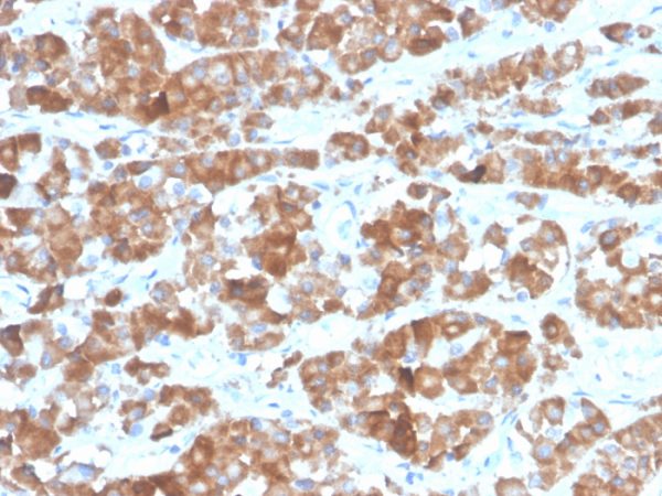 Formalin-fixed, paraffin-embedded human pituitary stained with LH-beta Recombinant Rabbit Monoclonal Antibody (LHb/1612R).