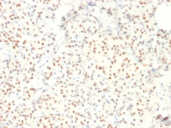 LMO2 (B-Cell Marker) Antibody - Image 2