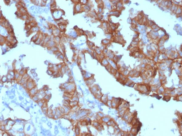 EpCAM Antibody in Immunohistochemistry (IHC (P))