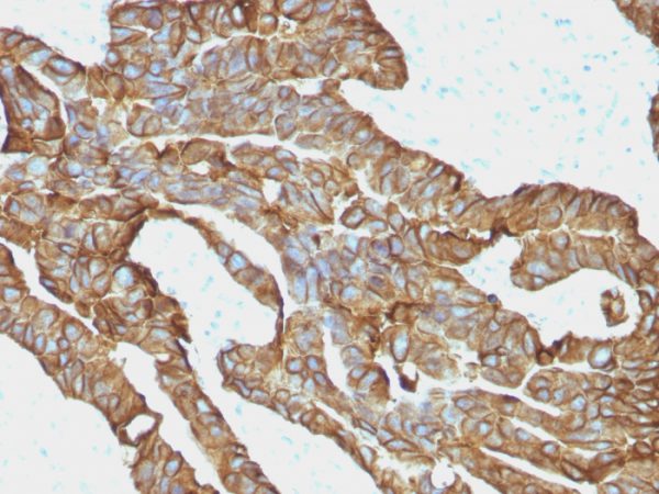 EpCAM Antibody in Immunohistochemistry (IHC (P))