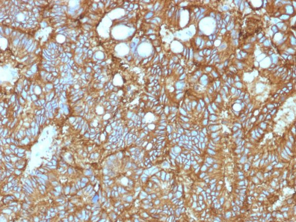 EpCAM Antibody in Immunohistochemistry (IHC (P))