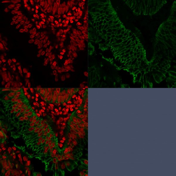 EpCAM Antibody in Immunofluorescence (IF)