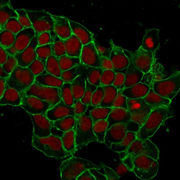 EpCAM Antibody in Immunofluorescence (IF)