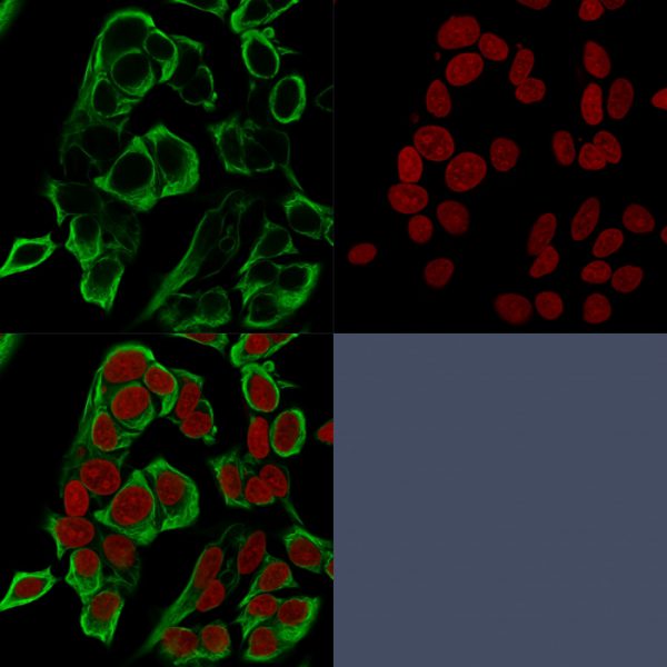 Confocal immunofluorescence analysis of MeOH-fixed MCF-7 cells using EpCAM Mouse Recombinant Monoclonal Antibody (rMOC-31) labeled in green. RedDot is used to stain the nuclei red.