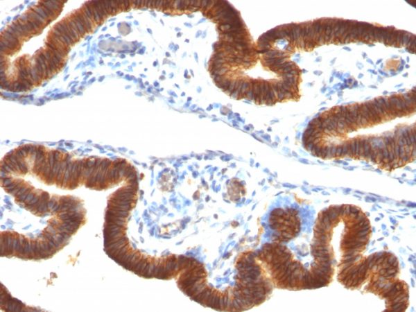 EpCAM Antibody in Immunohistochemistry (IHC (P))