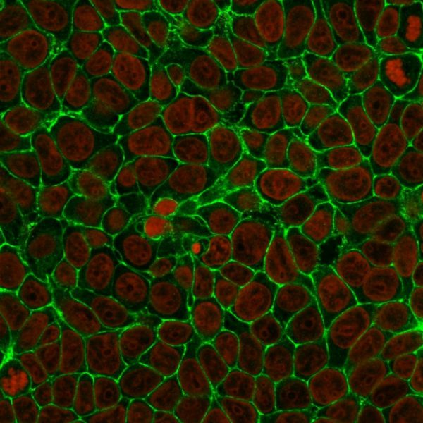 EpCAM Antibody in Immunofluorescence (IF)