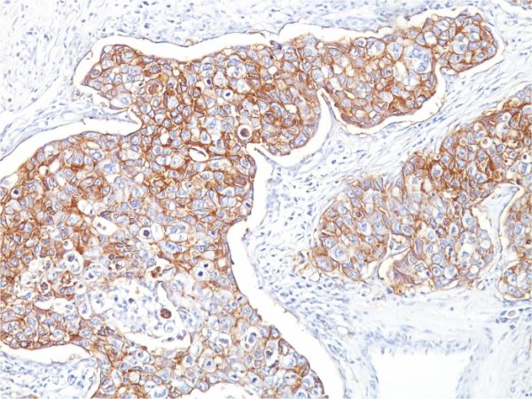 Ep-CAM / CD326 (Extracellular Domain) (Epithelial Marker) Antibody