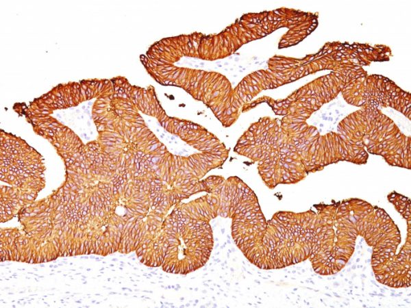 EpCAM Antibody in Immunohistochemistry (IHC (P))