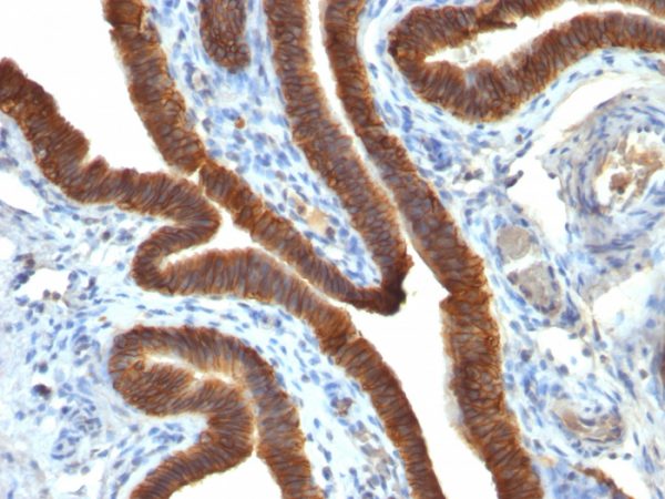 EpCAM Antibody in Immunohistochemistry (IHC (P))