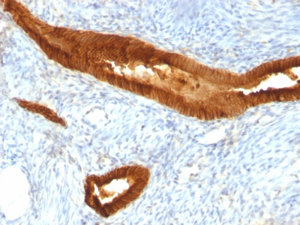 EpCAM Antibody in Immunohistochemistry (IHC (P))