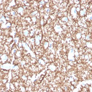 Formalin-fixed, paraffin-embedded human brain stained with Myelin Basic Protein Mouse Monoclonal Antibody (MBP/4271).