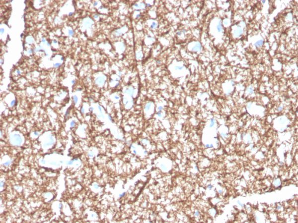 Myelin Basic Protein Antibody