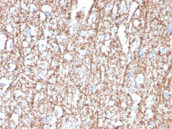 Formalin-fixed, paraffin-embedded human brain stained with Myelin Basic Protein Mouse Monoclonal Antibody (MBP/4272).