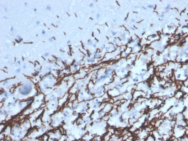 Formalin-fixed, paraffin-embedded human brain stained with MBP Recombinant Rabbit Monoclonal Antibody (MBP/4277R).