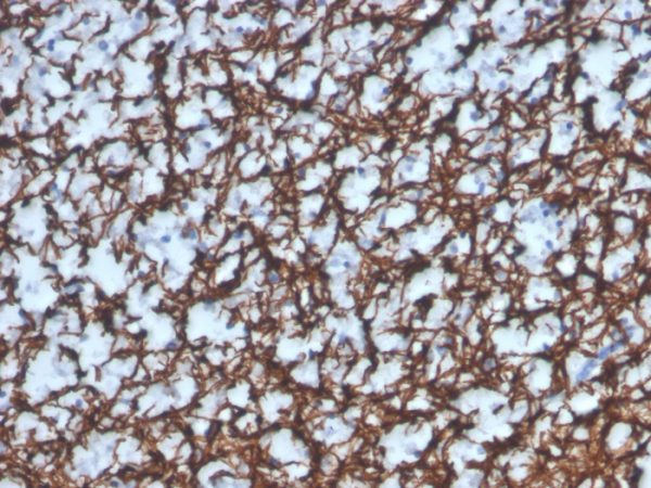 Formalin-fixed, paraffin-embedded human brain stained with MBP Recombinant Rabbit Monoclonal Antibody (MBP/4277R).