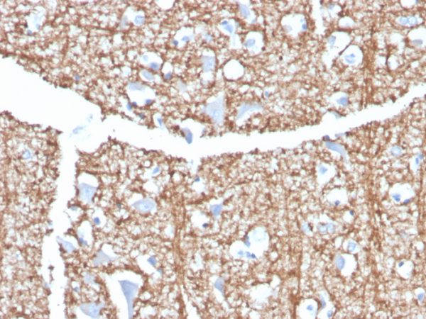 Formalin-fixed, paraffin-embedded human brain stained with Myelin Basic Protein Rat Monoclonal Antibody (MBP/4273).