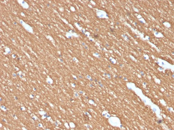 Formalin-fixed, paraffin-embedded human brain stained with Myelin Basic Protein Rat Monoclonal Antibody (MBP/4274).