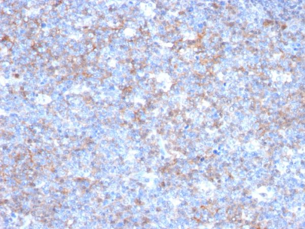 Formalin-fixed, paraffin-embedded human Tonsil stained with CD146 Monoclonal Antibody (C146/634)