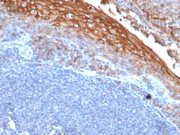 Formalin-fixed, paraffin-embedded human Tonsil stained with MUC18 Mouse Monoclonal Antibody (MUC18/1130).