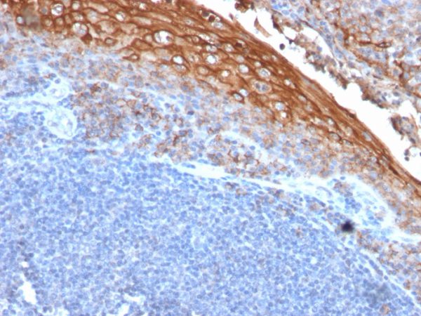 Formalin-fixed, paraffin-embedded human Tonsil stained with MUC18 Mouse Recombinant Monoclonal Antibody (rMUC18/1130).