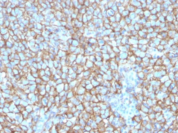 MCAM (Melanoma Cell Adhesion Molecule) / MUC18 / CD146 Antibody