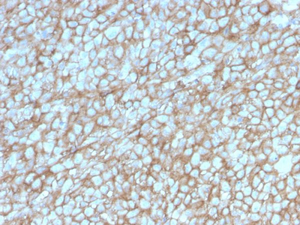 MCAM (Melanoma Cell Adhesion Molecule) / MUC18 / CD146 Antibody - Image 2