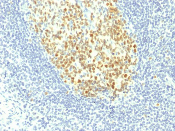 MCM7 (Proliferation Marker) Antibody