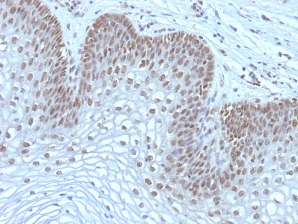 MAP3K1 (Mitogen-Activated Protein Kinase Kinase Kinase 1) Antibody - Image 3