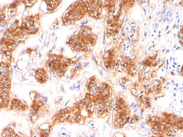 Milk Fat Globule (Breast Epithelial Marker) Antibody