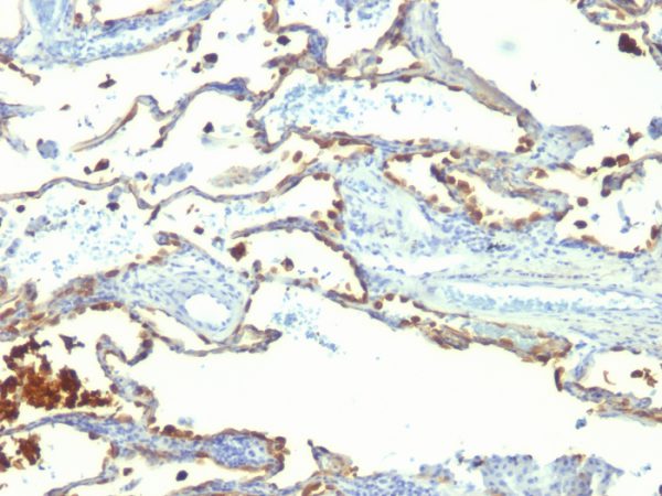 Milk Fat Globule (Breast Epithelial Marker) Antibody - Image 4