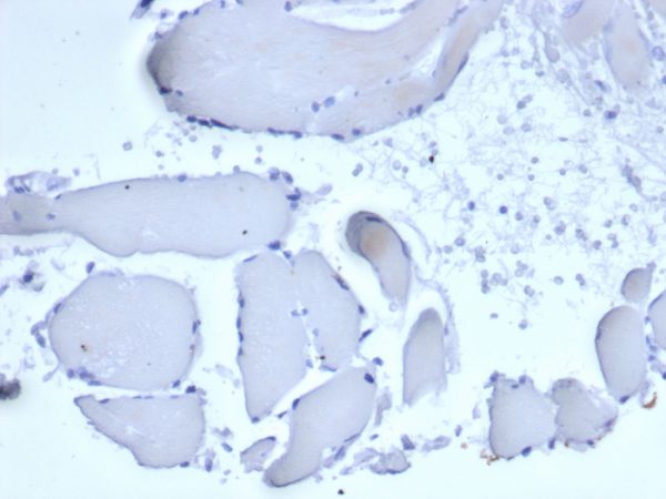 IHC analysis of formalin-fixed, paraffin-embedded human skeletal muscle. Negative tissue control using rMGB/6619 at 2ug/ml in PBS for 30min RT. HIER: Tris/EDTA, pH9.0, 45min. 2°C: HRP-polymer, 30min. DAB, 5min.