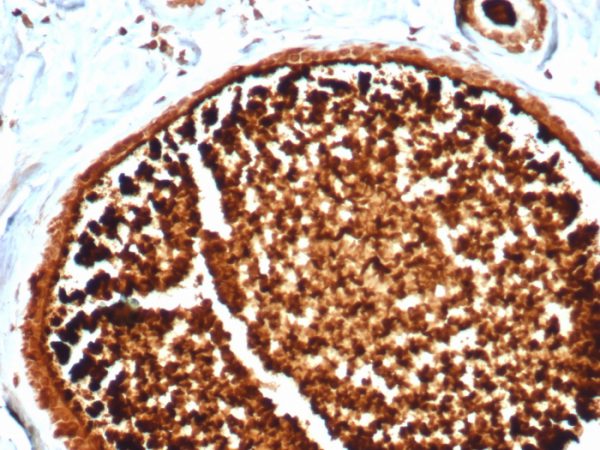 Formalin-fixed, paraffin-embedded human lactating breast stained with Mammaglobin Recombinant Rabbit Monoclonal Antibody (MGB/4812R).